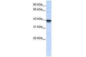 WB Suggested Anti-ETV3L Antibody Titration:  0. (ETV3L anticorps  (C-Term))
