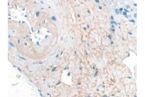 Detection of ELN in Human Liver Tissue using Monoclonal Antibody to Elastin (ELN) (Elastin anticorps  (AA 392-645))