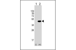 Western blot analysis of Tag-HA. (HA-Tag anticorps)