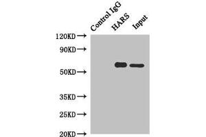 Immunoprecipitating HARS in Hela whole cell lysate Lane 1: Rabbit control IgG instead of (1 μg) instead of ABIN7155257 in Hela whole cell lysate. (HARS1/Jo-1 anticorps  (AA 1-180))