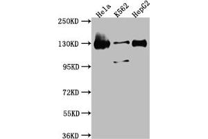 Western Blot Positive WB detected in: Hela whole cell lysate, K562 whole cell lysate, HepG2 whole cell lysate All lanes: Bub1 antibody at 1:1000 Secondary Goat polyclonal to rabbit IgG at 1/50000 dilution Predicted band size: 123, 116, 120 kDa Observed band size: 130 kDa (Recombinant BUB1 anticorps)