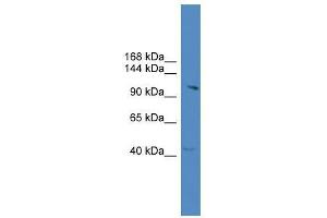 KIAA1604 antibody used at 0. (CWC22 anticorps  (C-Term))