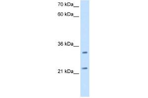 WB Suggested Antibody Titration:  2. (C21orf33 anticorps  (N-Term))