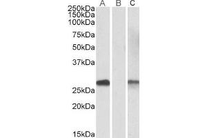 Lane A - ABIN571107 (1µg/ml) staining of HEK293 overexpressing Human DYDC1 lysate (10µg protein in RIPA buffer) Lane B - ABIN571107 (0. (DYDC1 anticorps  (AA 142-154))
