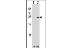 Western blot analysis of DUSP14 (arrow) using rabbit polyclonal DUSP14 Antibody (M1) (ABIN392877 and ABIN2842285).