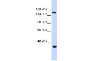 EIF4G3 antibody used at 1 ug/ml to detect target protein. (EIF4G3 anticorps  (Middle Region))