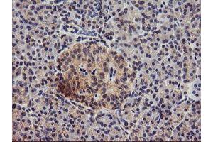Immunohistochemical staining of paraffin-embedded Human pancreas tissue using anti-DGKA mouse monoclonal antibody. (DGKA anticorps)
