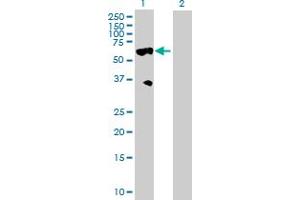 Western Blot analysis of HABP2 expression in transfected 293T cell line by HABP2 MaxPab polyclonal antibody. (HABP2 anticorps  (AA 1-560))