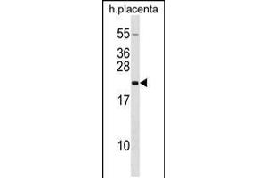 Western blot analysis in human placenta tissue lysates (35ug/lane). (Growth Hormone 2 anticorps  (N-Term))