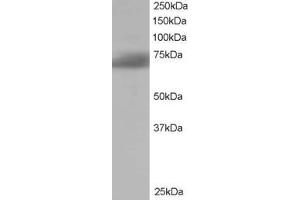 ABIN185183 staining (1µg/ml) of Human Brain lysate (RIPA buffer, 35µg total protein per lane). (SH3BP1 anticorps  (C-Term))