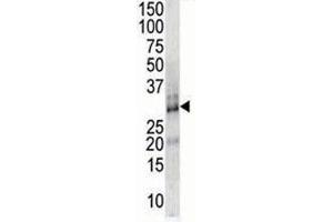 DSCR1 antibody used in western blot to detect DSCR1 in endothelial cell lysate