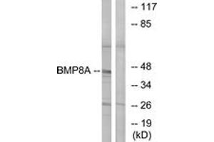 Western blot analysis of extracts from COLO cells, using BMP8A Antibody. (BMP8A anticorps  (AA 253-302))
