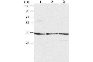 Western Blot analysis of NIH/3T3, A431 and Jurkat cell using RPLP0 Polyclonal Antibody at dilution of 1:750 (RPLP0 anticorps)