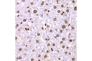 Immunohistochemistry of paraffin-embedded mouse liver using SSRP1 antibody.