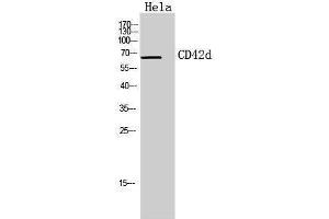 Western Blotting (WB) image for anti-Glycoprotein V (Platelet) (GP5) (Internal Region) antibody (ABIN3178933) (GP5 anticorps  (Internal Region))