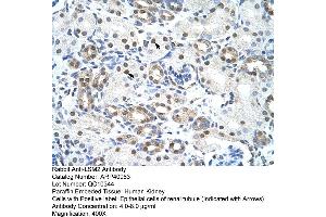 Rabbit Anti-LSM2 Antibody  Paraffin Embedded Tissue: Human Kidney Cellular Data: Epithelial cells of renal tubule Antibody Concentration: 4. (LSM2 anticorps  (Middle Region))