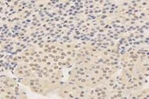 Immunohistochemistry analysis of paraffin-embedded rat adrenal gland using,TPRKB (ABIN7075943) at dilution of 1: 4200