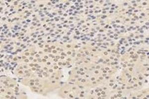 Immunohistochemistry analysis of paraffin-embedded rat adrenal gland using,TPRKB (ABIN7075943) at dilution of 1: 4200 (TPRKB anticorps)