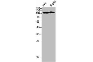 Western Blot analysis of 3T3 HEPG2 cells using Collagen alpha-1(XXVIII)Polyclonal Antibody diluted at 1:1000. (COL28A1 anticorps  (AA 111-160))