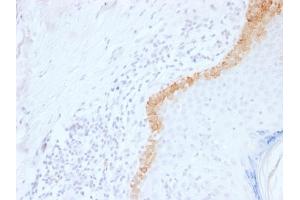 Formalin-fixed, paraffin-embedded human Skin stained with Cytokeratin 15 Mouse Monoclonal Antibody (LHK15). (KRT15 anticorps  (C-Term))