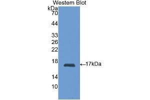 Western blot analysis of the recombinant protein. (RBP1 anticorps  (AA 2-135))
