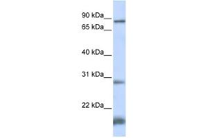 WB Suggested Anti-SMYD4 Antibody Titration:  0. (SMYD4 anticorps  (N-Term))