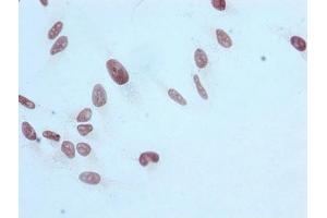 Immunocytochemistry analysis of ABIN7127303 diluted at 1:100 and staining in Hela cells performed on a Leica BondTM system.