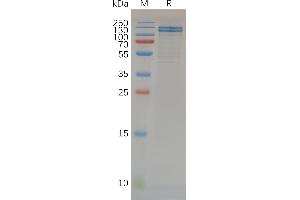 Human Protein, hFc Tag on SDS-PAGE under reducing condition.