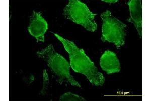 Immunofluorescence of monoclonal antibody to PLCG1 on HeLa cell.