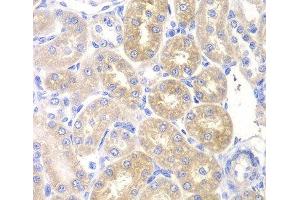 Immunohistochemistry of paraffin-embedded Rat kidney using PNLIP Polyclonal Antibody at dilution of 1:200 (40x lens). (PNLIP anticorps)