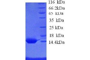 Serum Amyloid A1 (SAA1) (AA 1-110), (full length) protein (His tag)