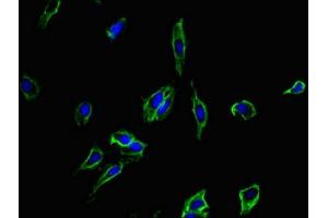 Immunofluorescent analysis of Hela cells using ABIN7173887 at dilution of 1:100 and Alexa Fluor 488-congugated AffiniPure Goat Anti-Rabbit IgG(H+L) (CD40 anticorps  (AA 21-193))