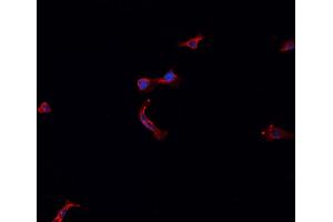 ABIN6266937 staining LTEP cells by IF/ICC.