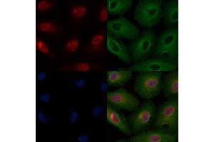 ABIN6259857 and ABIN6266711 staining  cells by IF/ICC. (AKAP8 anticorps  (Internal Region))