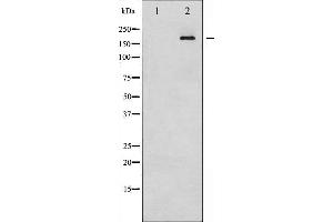 Western blot analysis of IRS-1 phosphorylation expression in HT29 whole cell lysates,The lane on the left is treated with the antigen-specific peptide.