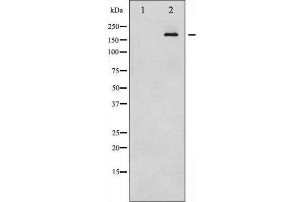 IRS1 anticorps  (pSer312)