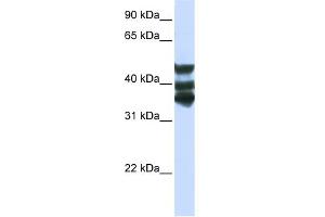 WB Suggested Anti-HGD Antibody Titration:  0. (HGD anticorps  (Middle Region))
