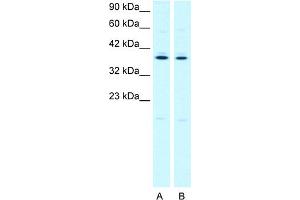 WB Suggested Anti-PTGER3 Antibody Titration:  2. (PTGER3 anticorps  (C-Term))