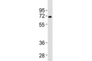 Western blot testing of SPHK2 antibody at 1:2000 dilution + human liver lysate (SPHK2 anticorps  (N-Term))