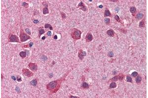 anti-Autophagy Related 12 (ATG12) (AA 79-128) antibody