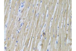 Immunohistochemistry of paraffin-embedded rat heart using P2RY2 antibody (ABIN6293436) at dilution of 1:100 (40x lens). (P2RY2 anticorps)