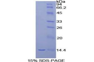 SDS-PAGE analysis of Rat MIP1g Protein.