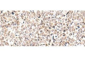 anti-Ewing Sarcoma Breakpoint Region 1 (EWSR1) antibody