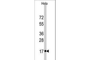 Western blot analysis of IFITM3 polyclonal antibody  in HeLa cell line lysates (35 ug/lane). (IFITM3 anticorps  (Internal Region))