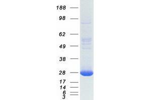 Validation with Western Blot