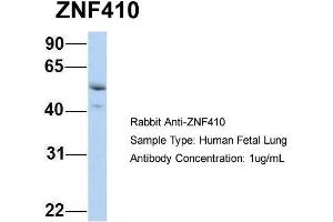 Host: Rabbit Target Name: ZNF410 Sample Type: Human Fetal Lung Antibody Dilution: 1. (ZNF410 anticorps  (N-Term))