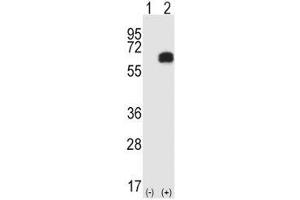 Western blot analysis of RIPK2 antibody and 293 cell lysate either nontransfected (Lane 1) or transiently transfected (2) with the RIPK2 gene. (RIPK2 anticorps  (AA 458-488))