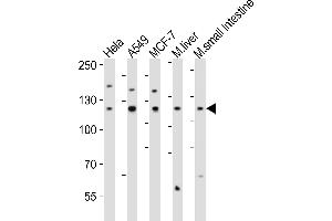Western blot analysis of lysates from Hela, A549, MCF-7 cell line, mouse liver, mouse small intestine tissue lysate(from left to right), using ZN Antibody (Center) (ABIN6242706 and ABIN6577885). (ZNF281 anticorps  (AA 416-450))