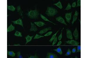 Immunofluorescence analysis of L929 cells using BMPR1B Polyclonal Antibody at dilution of 1:100.