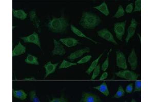 Immunofluorescence analysis of L929 cells using BMPR1B Polyclonal Antibody at dilution of 1:100. (BMPR1B anticorps)
